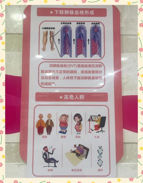 久坐族必学：5 个办公室隐形运动防血栓