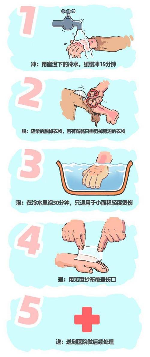 教你应对烫伤起泡：这 5 个处理步骤避免留疤