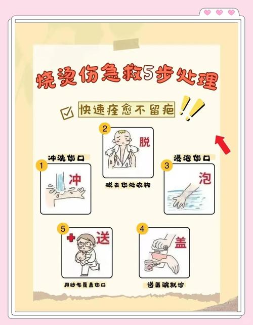 烫伤后正确处理：这 5 个步骤比涂牙膏更有效
