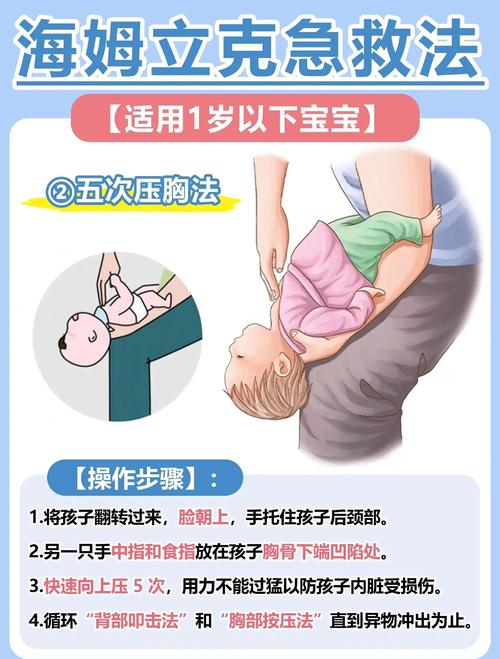 婴幼儿海姆立克急救法（详细图解版）