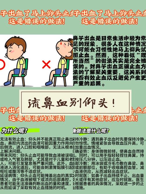 流鼻血仰头会致命?正确止血姿势及原因解析