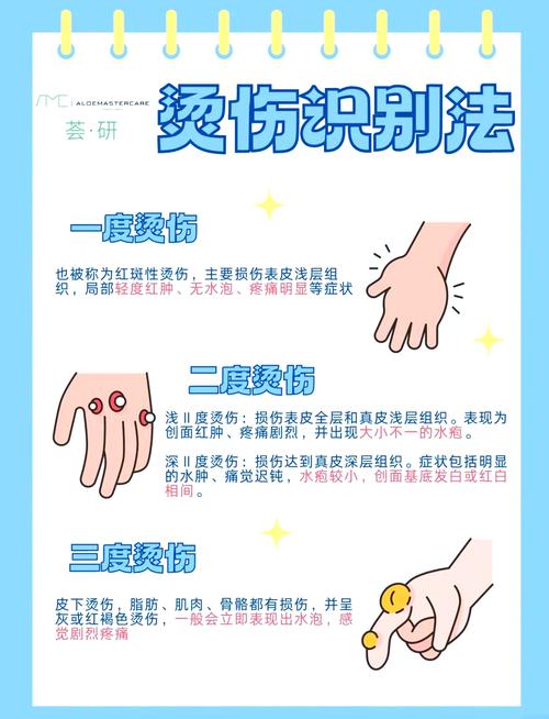 被热油烫伤后，这 5 种错误处理方式千万别做​