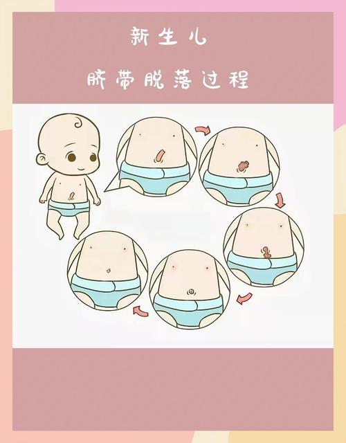 新生儿脐带护理:这 3 个步骤避免感染发炎