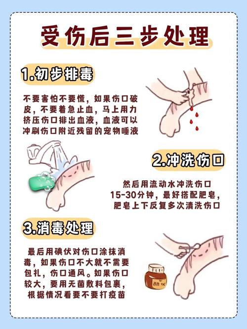 被宠物抓伤怎么办？这3种情况必须打疫苗！