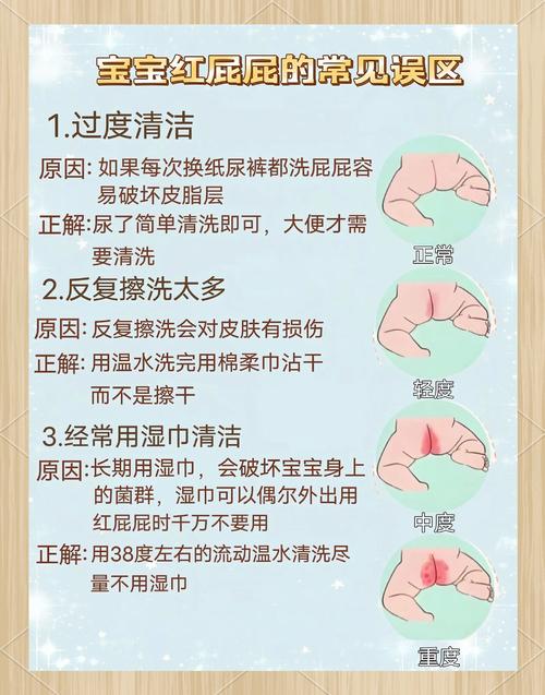 婴儿红屁股预防:这 4 个护理误区要避开