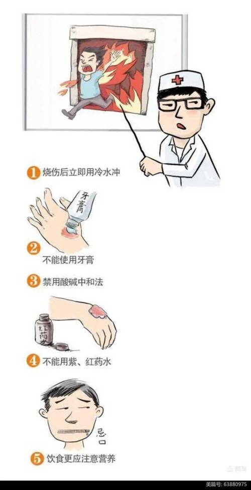 烫伤后第一件事不是抹牙膏！正确的五步急救法
