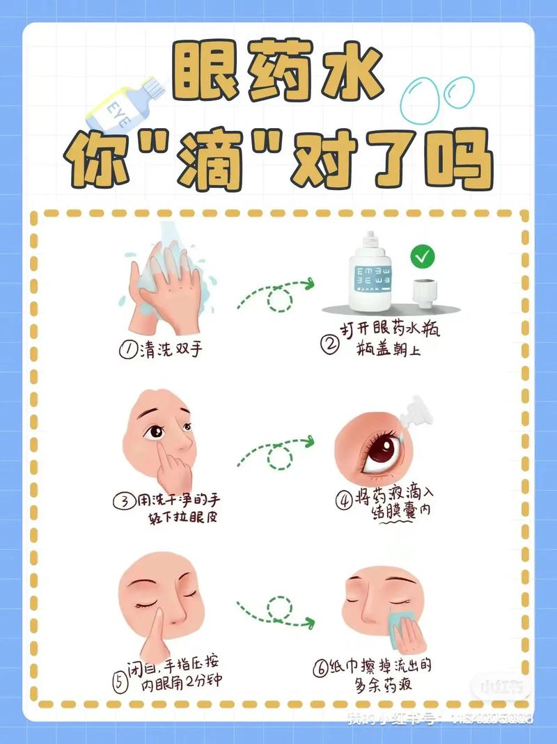 眼药水滴在眼睛哪个位置最合适？