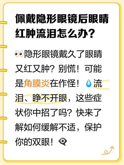 戴隐形眼镜睡觉会角膜溃疡？眼部护理常识​