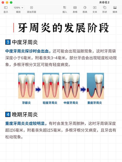刷牙出血是上火?牙龈问题自查与应对