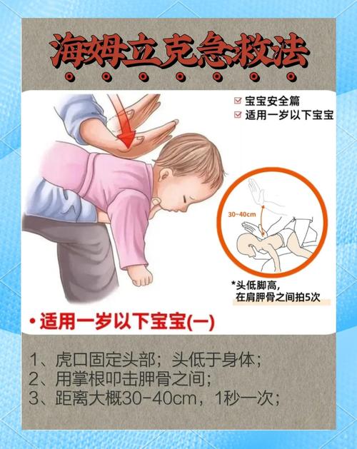 幼儿误吞异物急救法：不同年龄段处理差异
