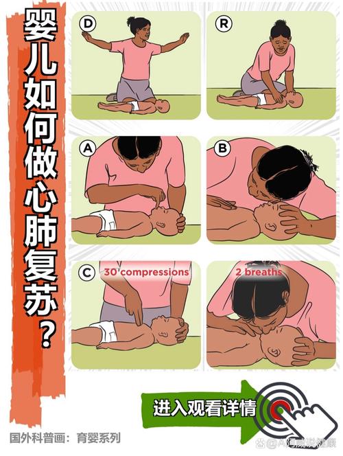 如何正确进行心肺复苏